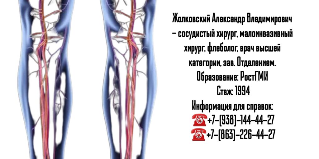 Жолковский Александр Владимирович - Ростов сосудистый хирург 