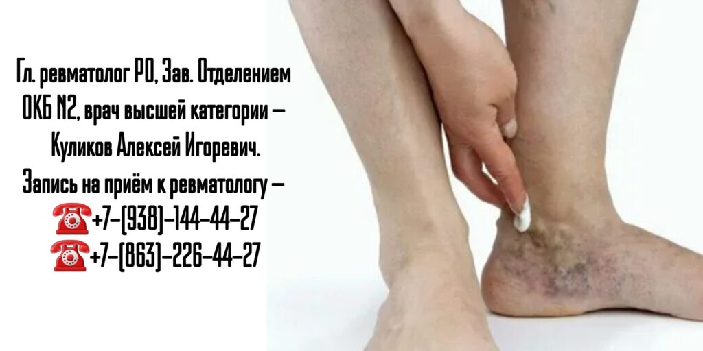 Куликов Алексей Игоревич- консультация ревматолога в Ростове-на-Дону  