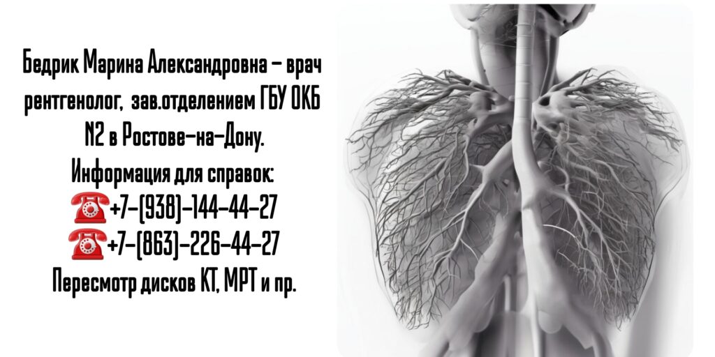Бедрик Марина Александровна - КТ бронхов и легких