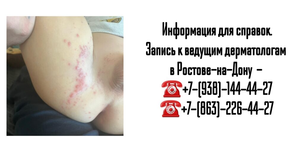 Ведущие дерматологи Ростова-на-Дону - лечение Девержи