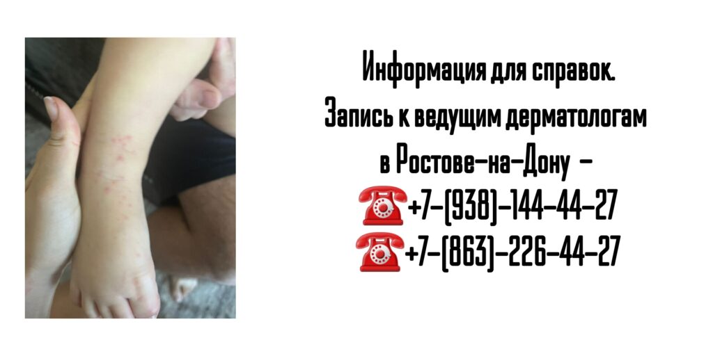 Ведущие дерматологи Ростова-на-Дону - лечение Девержи