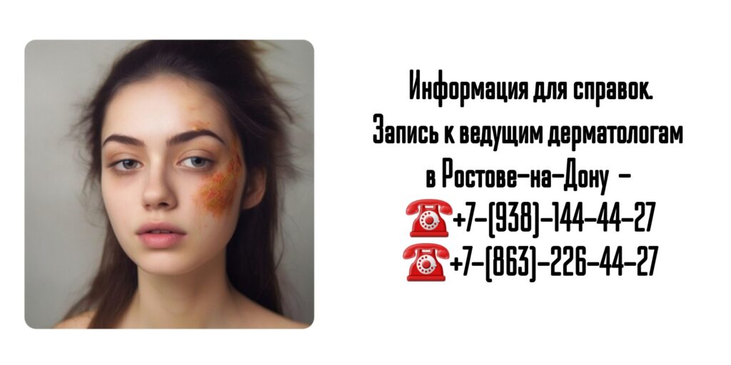 Ведущие дерматологи Ростова-на-Дону - лечение Девержи