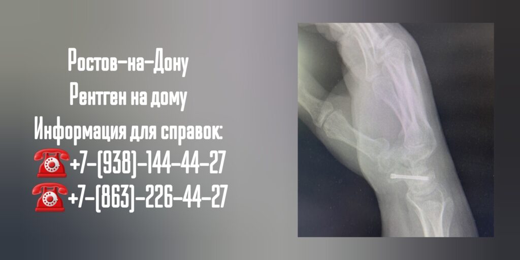 Рентген на дому в Ростове-на-Дону