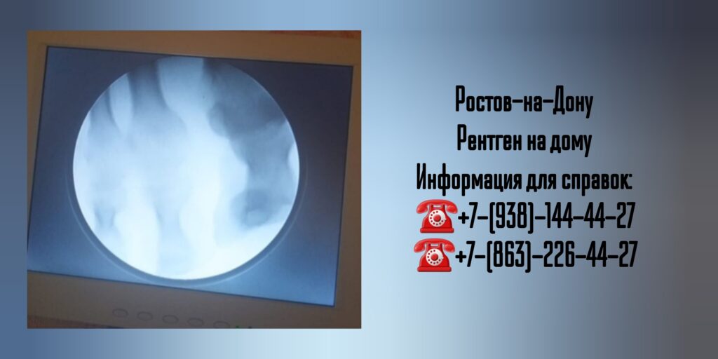 Рентген на дому в Ростове-на-Дону 