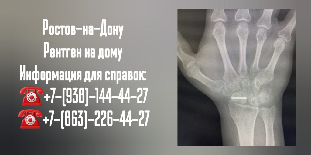 Рентген на дому в Ростове-на-Дону 