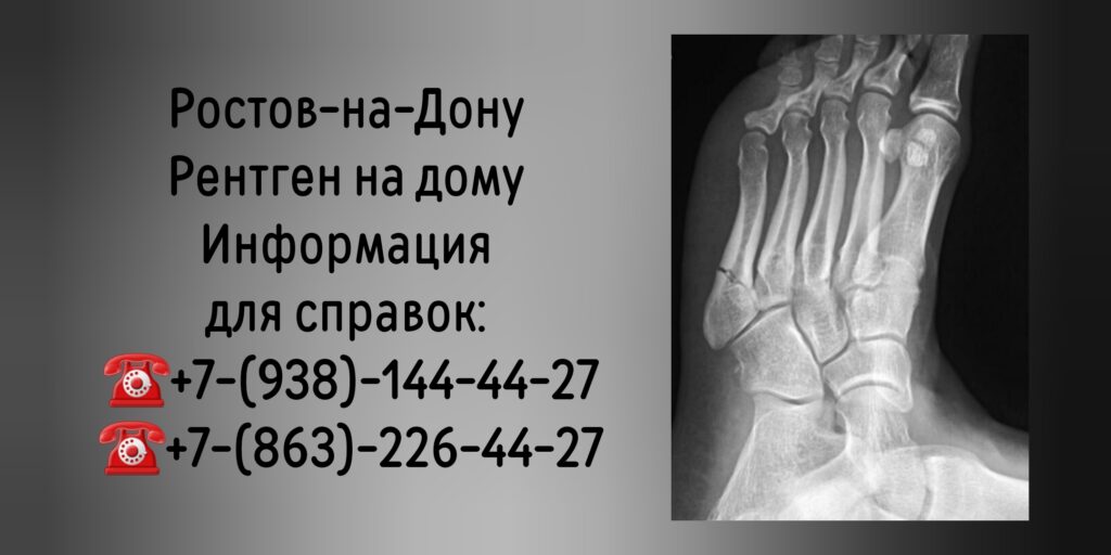 Рентген на дому в Ростове-на-Дону 
