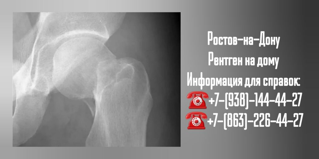 Рентген на дому в Ростове-на-Дону 