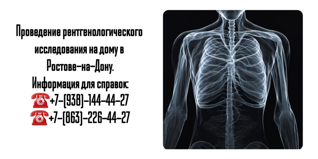 Рентген легких на дому в Ростове-на-Дону