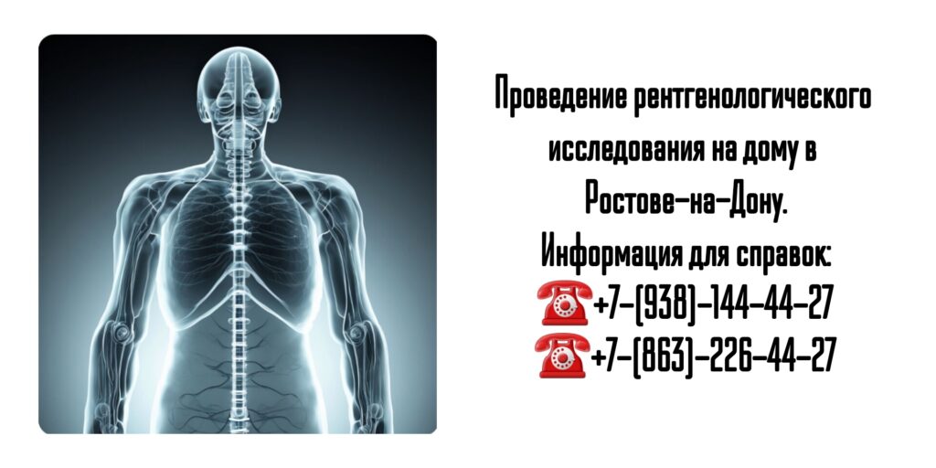 Рентген легких на дому в Ростове-на-Дону