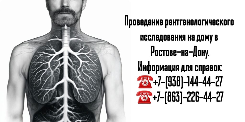 Рентген легких на дому в Ростове-на-Дону
