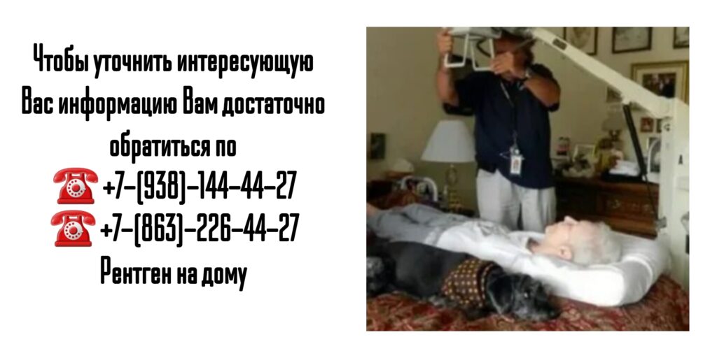 Рентген на дом Ростов - травма большого пальца ноги