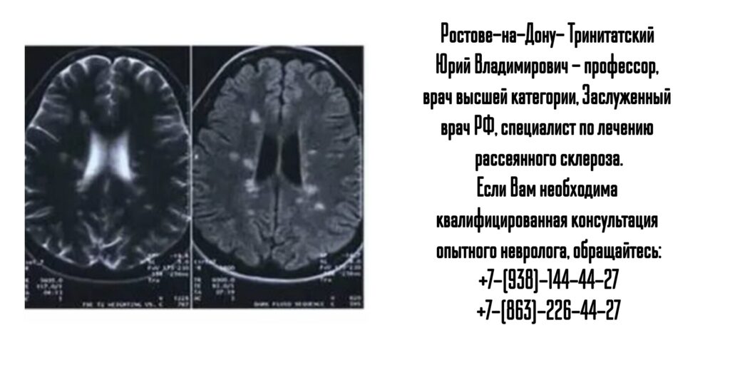 Тринитатский Юрий Владимирович - грамотный врач невролог в Ростове-на-Дону 