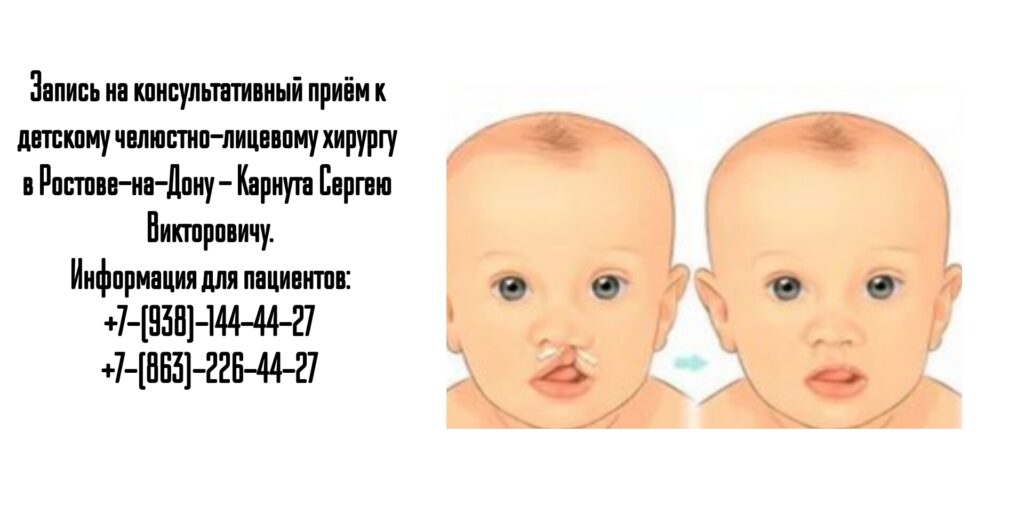 Сергей Викторович Карнута - детский челюстно-лицевой хирург в Ростове-на-Дону 