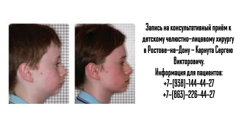 Сергей Викторович Карнута - детский челюстно-лицевой хирург в Ростове-на-Дону 