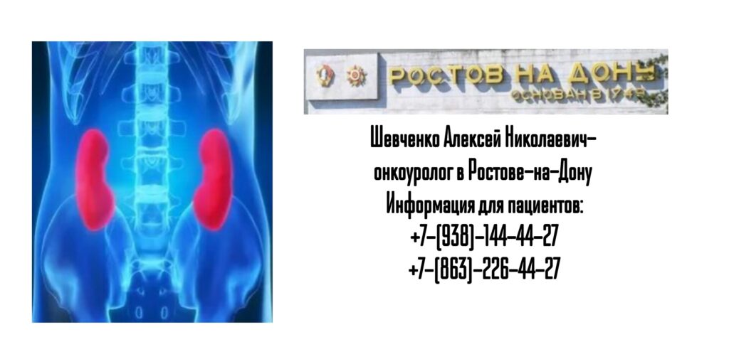 Шевченко Алексей Николаевич - онкоуролог в Ростове-на-Дону 