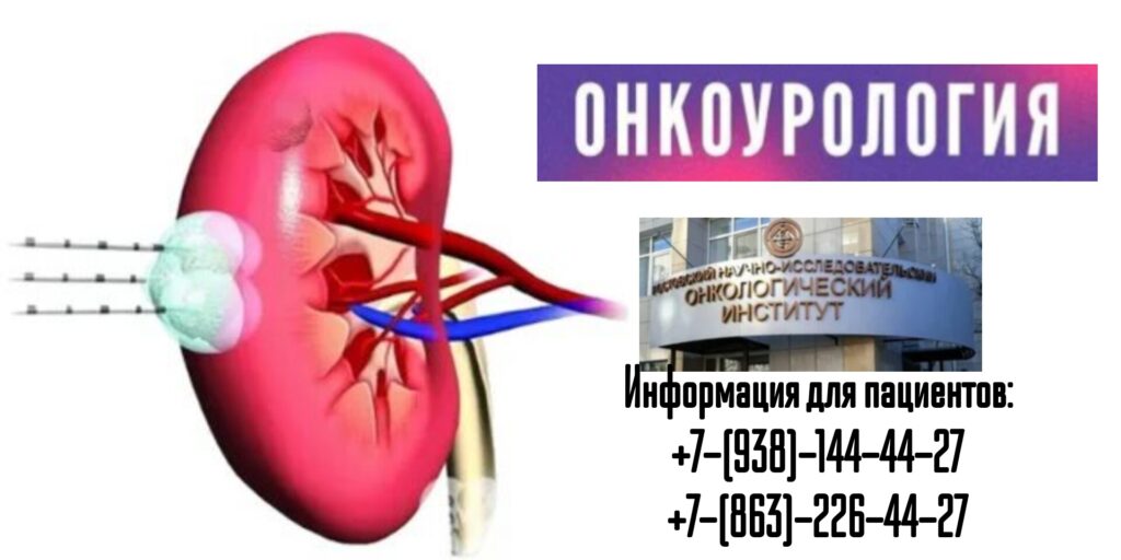 Шевченко Алексей Николаевич - онкоуролог в Ростове-на-Дону 