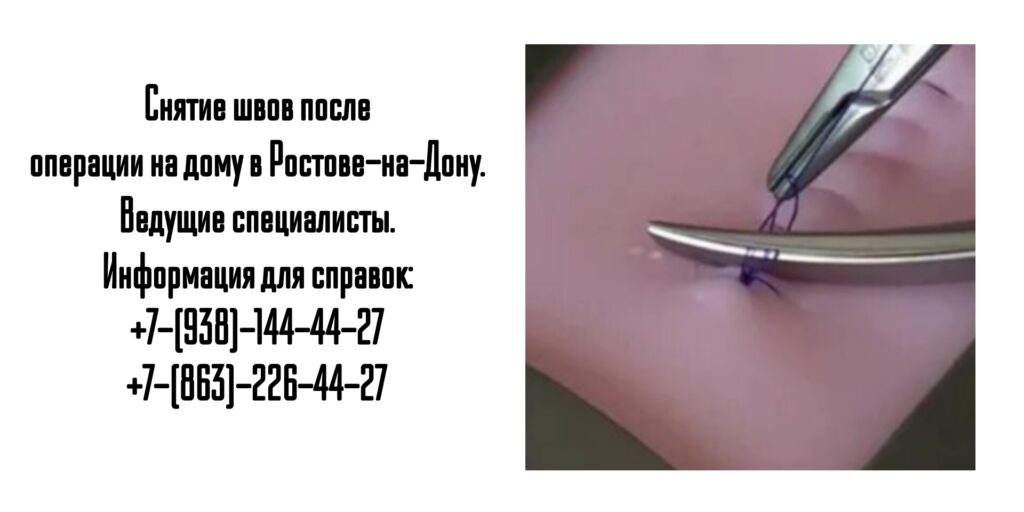 Снять послеоперационные швы на дому в Ростове-на-Дону