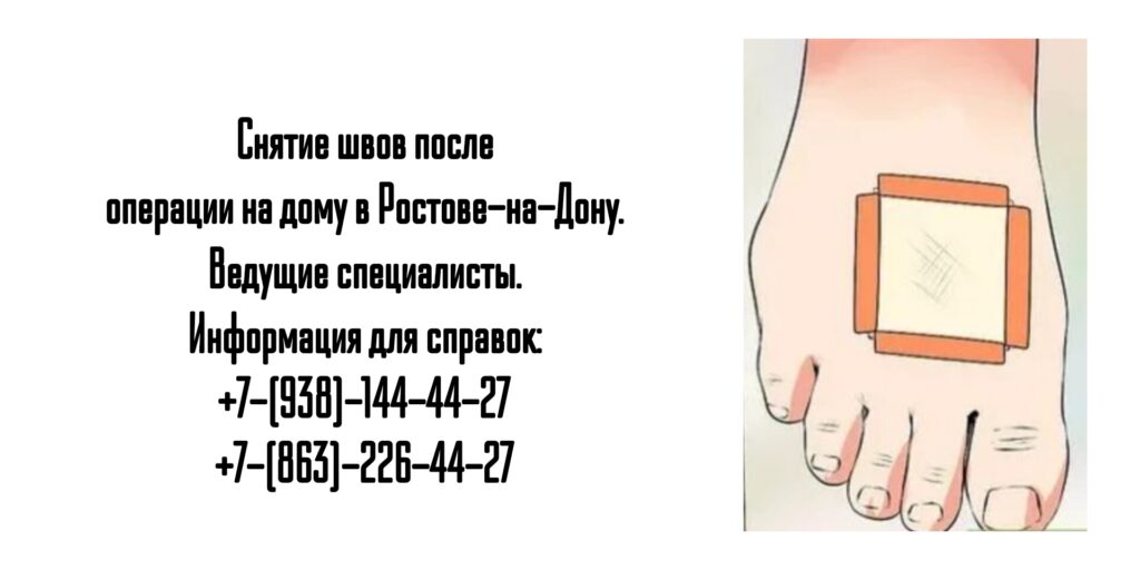 Снять послеоперационные швы на дому в Ростове-на-Дону