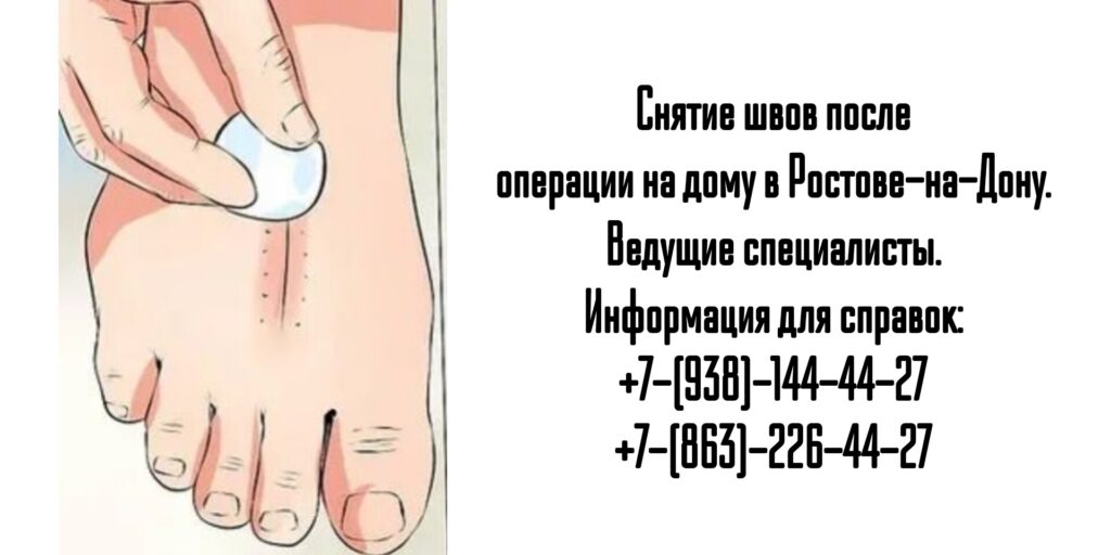 Снять послеоперационные швы на дому в Ростове-на-Дону