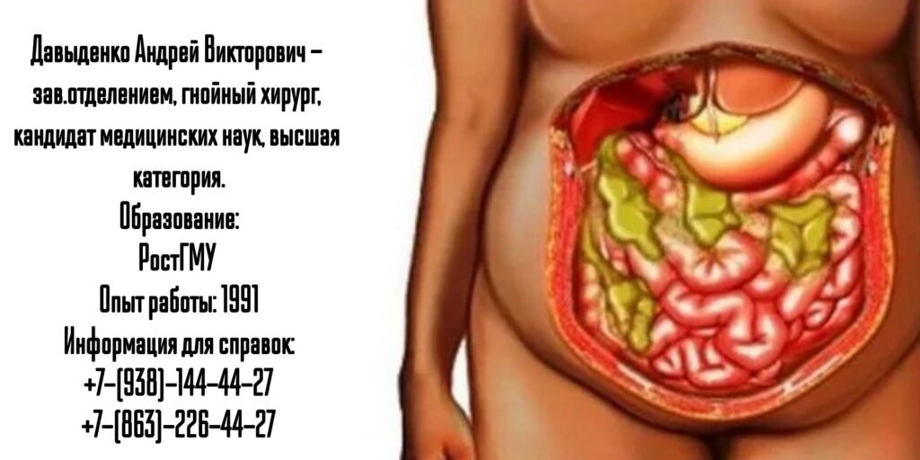 Давыденко Андрей Викторович- гнойный хирург в Ростове-на-Дону 