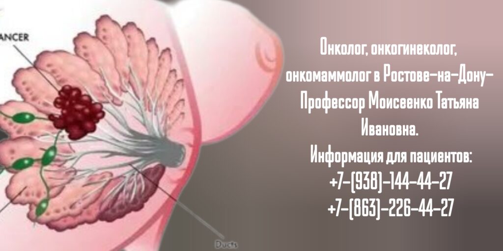 Запись к онкологу в Ростове-на-Дону- Моисеенко Татьяна Ивановна