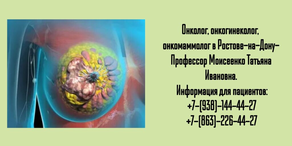 Запись к онкологу в Ростове-на-Дону- Моисеенко Татьяна Ивановна