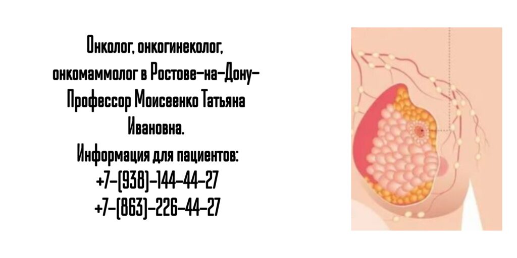Запись к онкологу в Ростове-на-Дону- Моисеенко Татьяна Ивановна