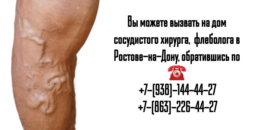 Вызов сосудистого хирурга на дом в Ростове-на-Дону- Сергеев В.А