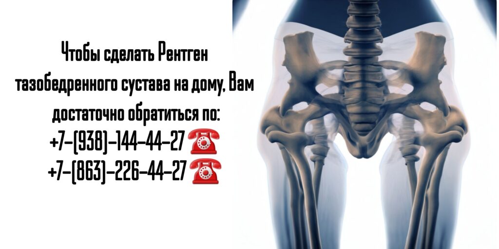 Рентген тазобедренного сустава на дому- Ростов-на-Дону 
