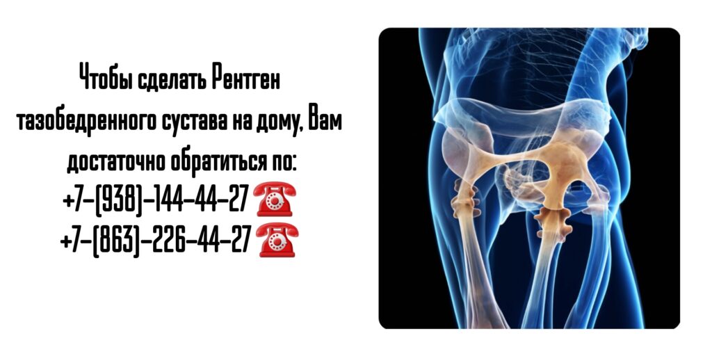 Рентген тазобедренного сустава на дому- Ростов-на-Дону 