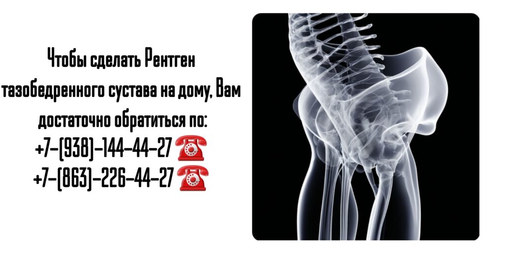 Рентген тазобедренного сустава на дому- Ростов-на-Дону 