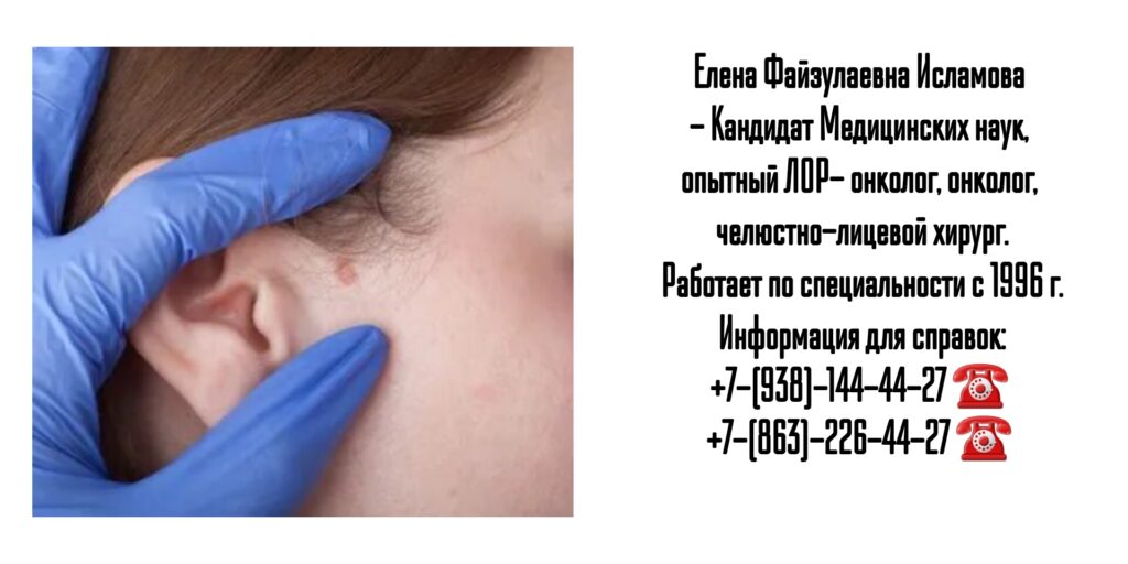 Исламова Елена Файзулаевна- ЛОР- онколог - челюстно-лицевой хирург в Ростове-на-Дону 