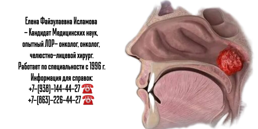 Исламова Елена Файзулаевна- ЛОР- онколог - челюстно-лицевой хирург в Ростове-на-Дону 