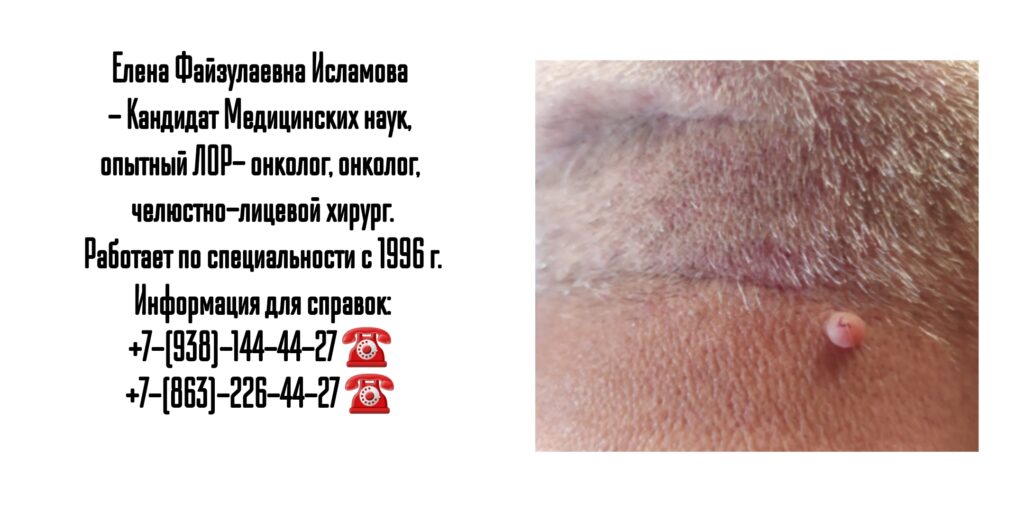 Исламова Елена Файзулаевна- ЛОР- онколог - челюстно-лицевой хирург в Ростове-на-Дону 