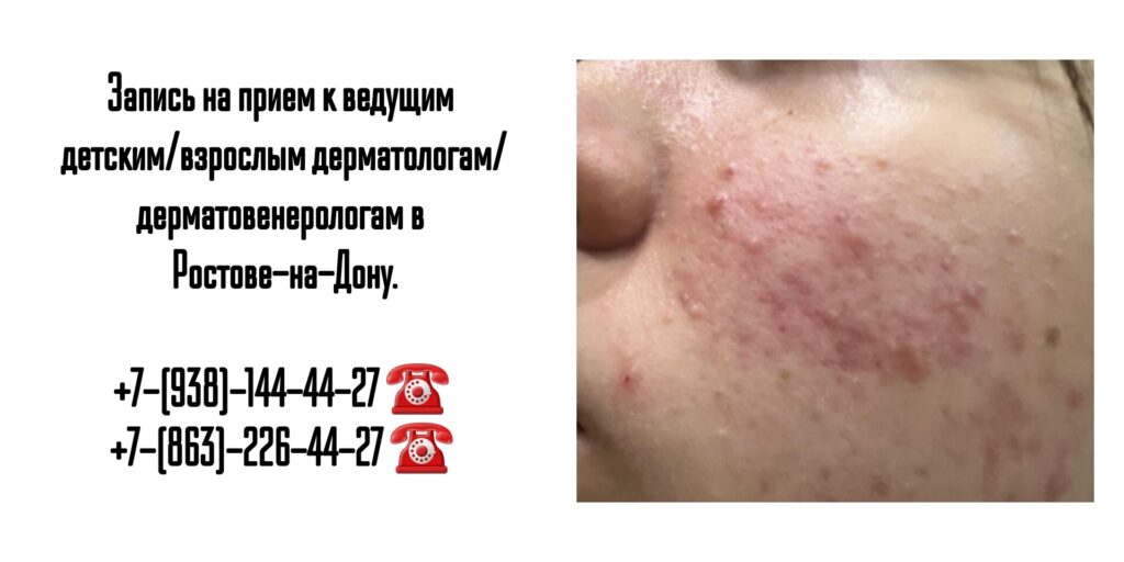 Ведущие дерматологи Ростова-на-Дону 