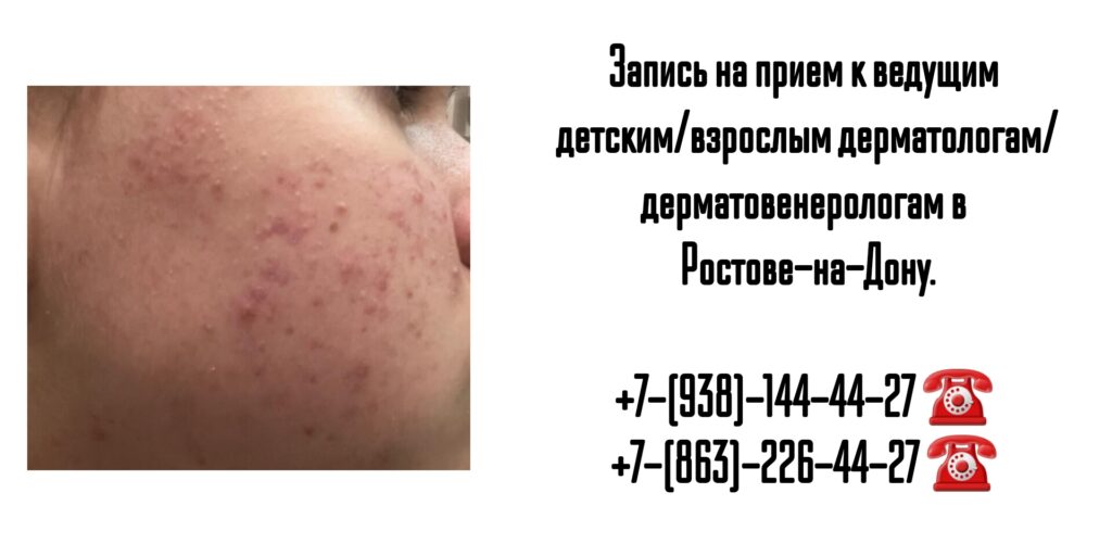 Ведущие дерматологи Ростова-на-Дону 