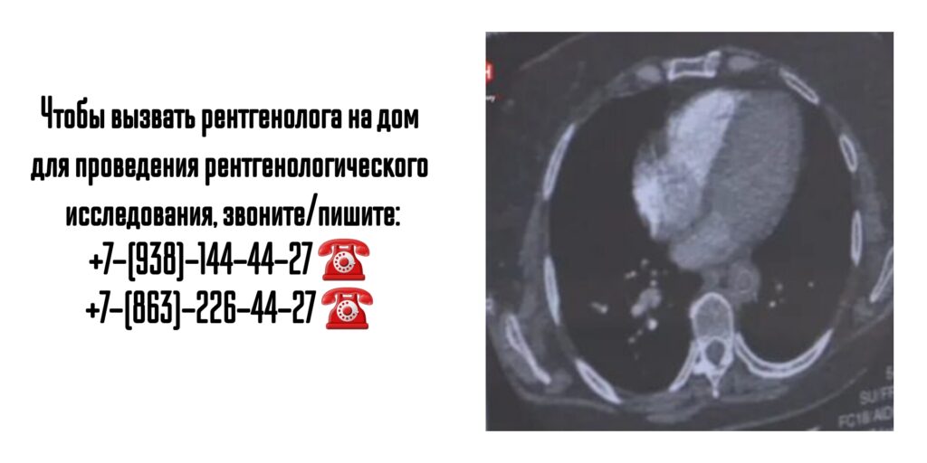 Рентген на дому- вызов врача на дом в Ростове-на-Дону 