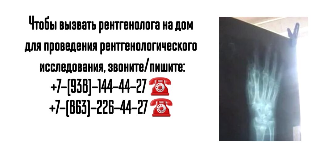 Рентген на дому- вызов врача на дом в Ростове-на-Дону 