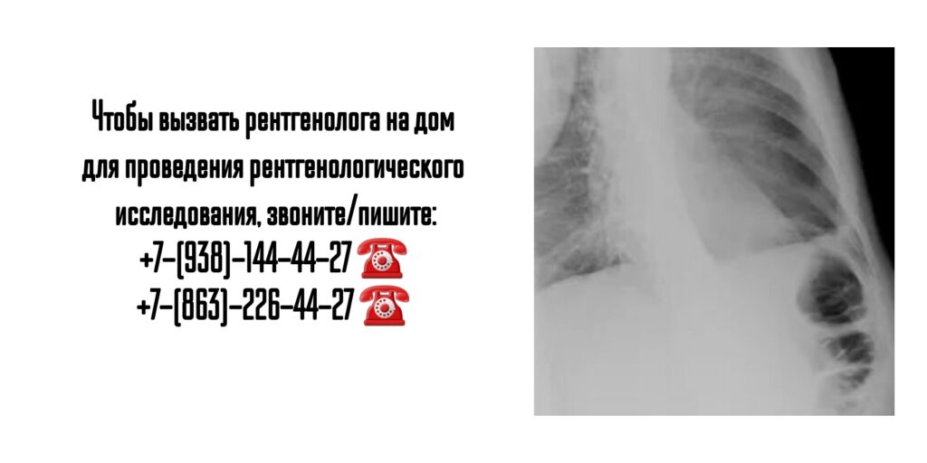 Рентген на дому- вызов врача на дом в Ростове-на-Дону 