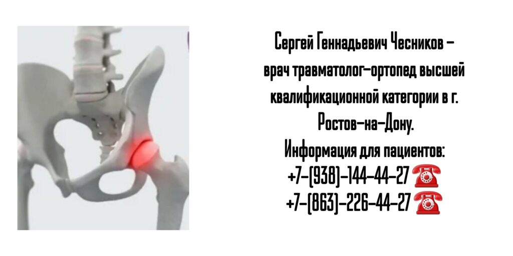 Чесников Сергей Геннадьевич - врач травматолог в Ростове-на-Дону 