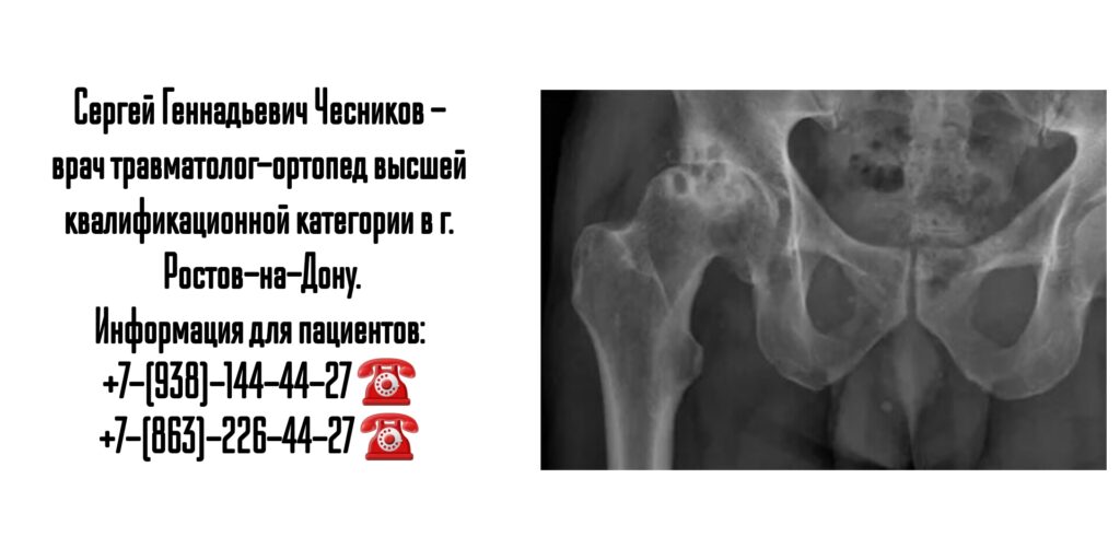 Чесников Сергей Геннадьевич - врач травматолог в Ростове-на-Дону 