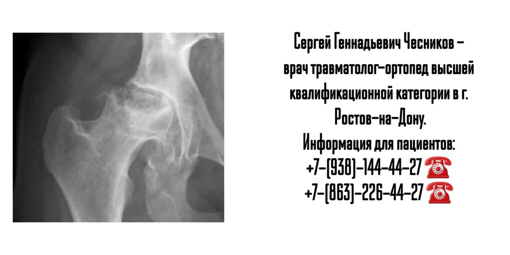 Чесников Сергей Геннадьевич - врач травматолог в Ростове-на-Дону 