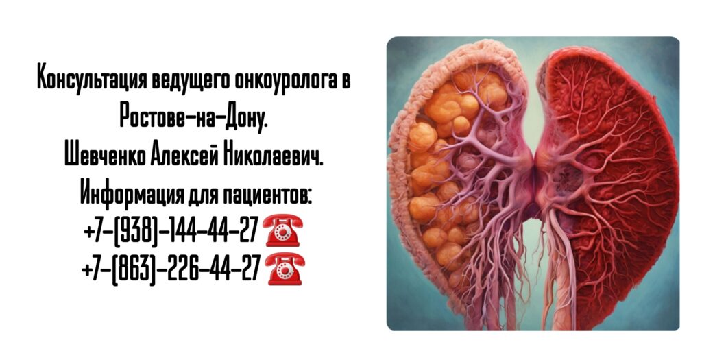 Онкоуролог в Ростове-на-Дону- Шевченко Алексей Николаевич 