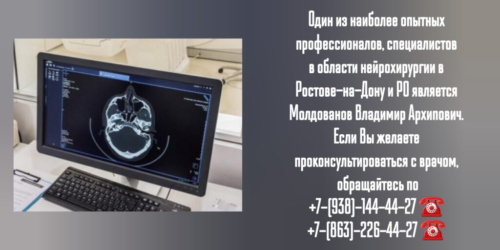Врач нейрохирург в Ростове-на-Дону- Молдованов Владимир Архипович