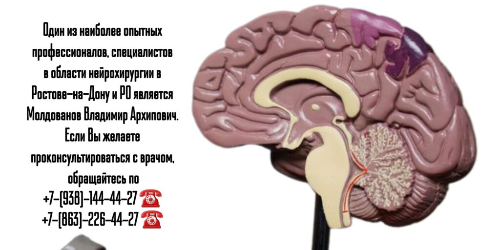 Врач нейрохирург в Ростове-на-Дону- Молдованов Владимир Архипович