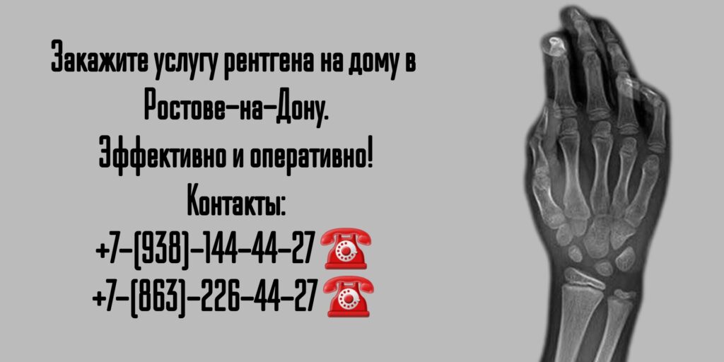 Рентген на дому в Ростове-на-Дону: удобно, быстро и качественно