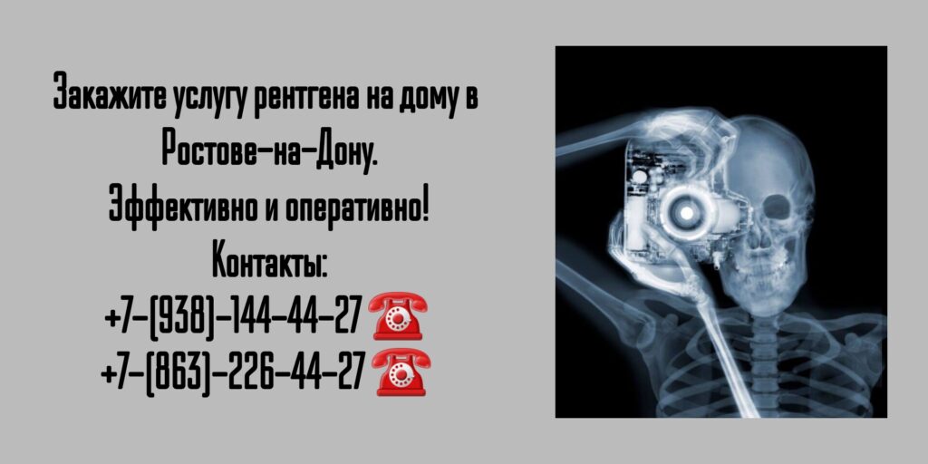 Рентген на дому в Ростове-на-Дону: удобно, быстро и качественно