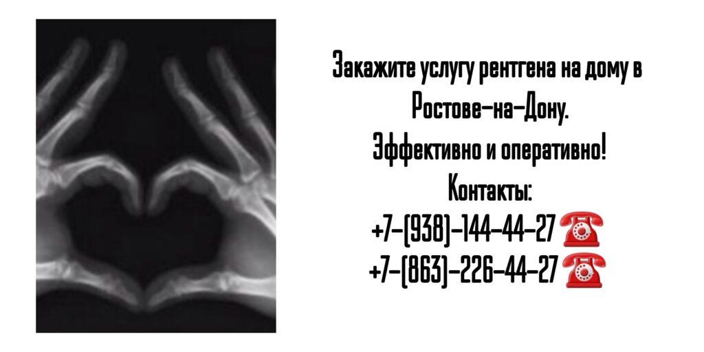Рентген на дому в Ростове-на-Дону: удобно, быстро и качественно