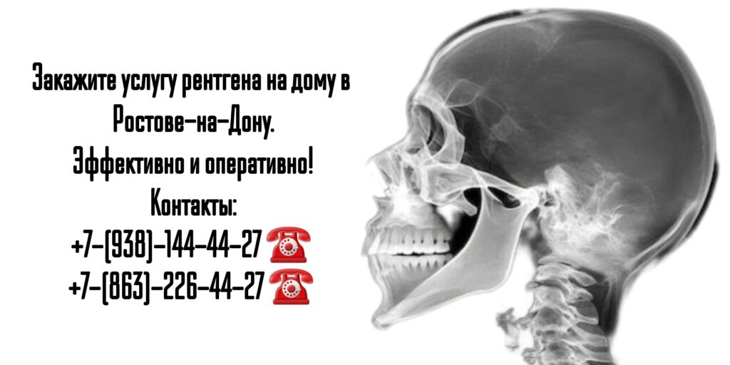Рентген на дому в Ростове-на-Дону: удобно, быстро и качественно