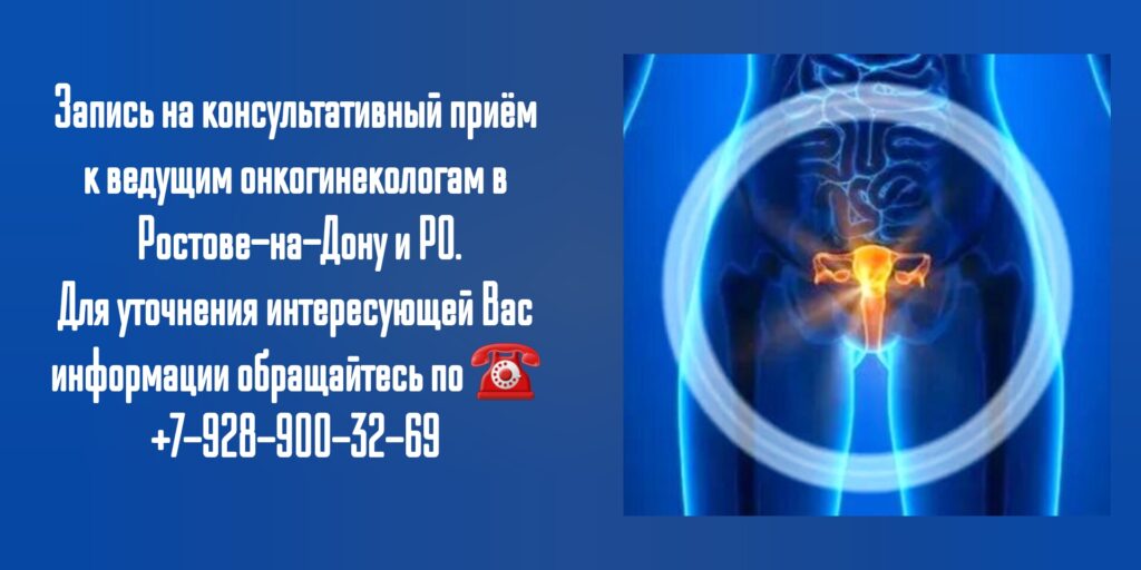 Ведущий онкологинеколог в Ростове-на-Дону- Ивановна Виктория Александровна